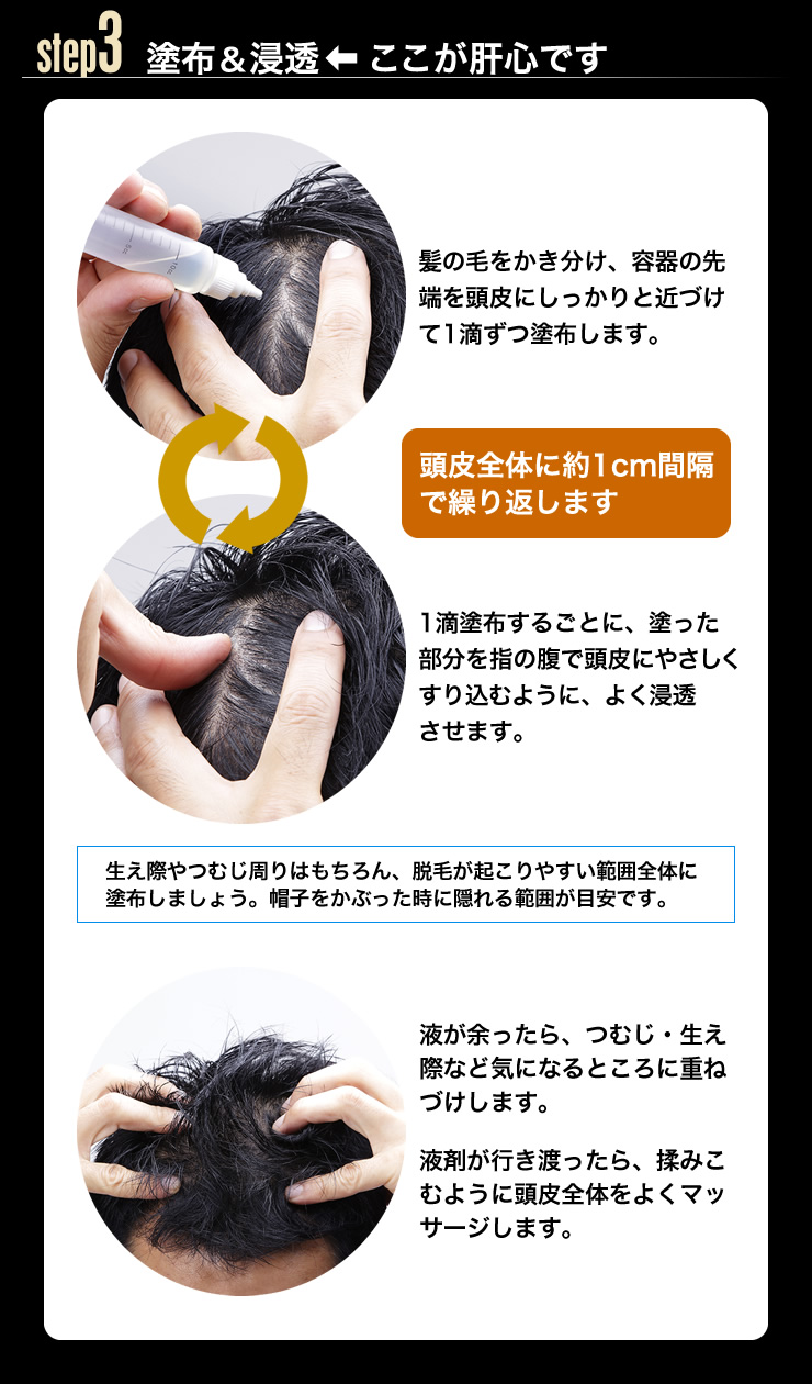 バイオテック スカルプローションβ 3本セット smcint.com